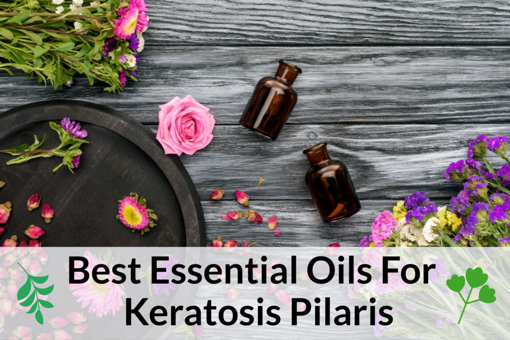 Best Essential Oils For Keratosis Pilaris: Fare Thee Well ‘Chicken Skin’ Essential Oil Benefits