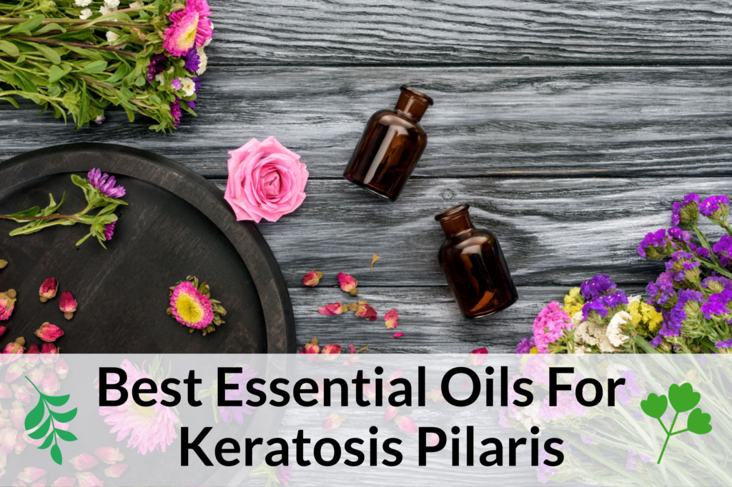 Meilleures huiles essentielles pour la kératose pilaire: Fare Thee Well 'Chicken Skin' Essential Oil Benefits