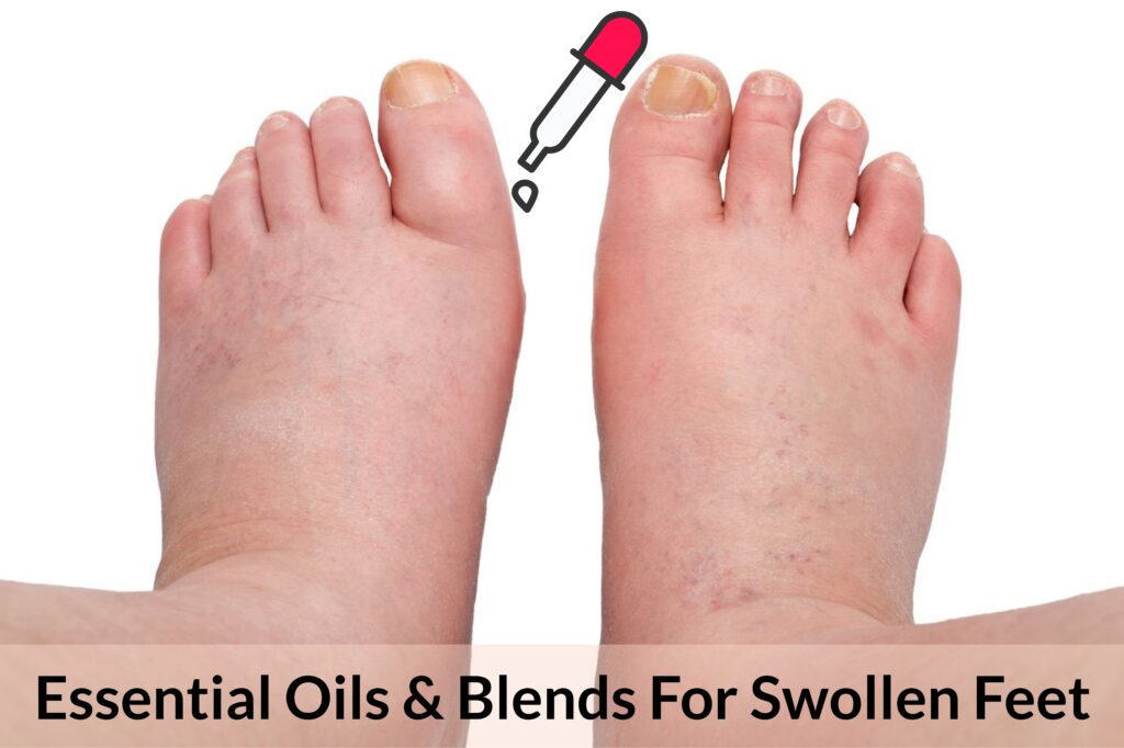 Essential Oils For Swollen Feet: When Your Feet Are More Bloated Than A Puffer Fish Essential Oil Benefits