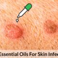 best essential oils for skin infections