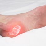 Essential oils for bone spurs