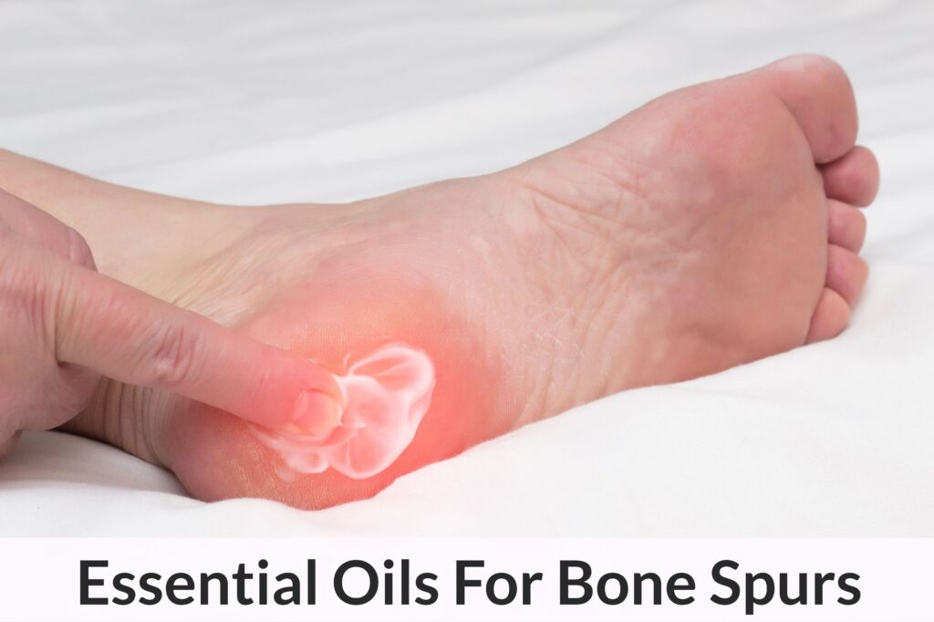 Essential Oils For Bone Spurs: When Being Porcupine Boy Doesn’t Sound So Heroic Anymore Essential Oil Benefits
